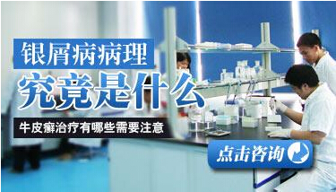 银屑病的病发原因是什么